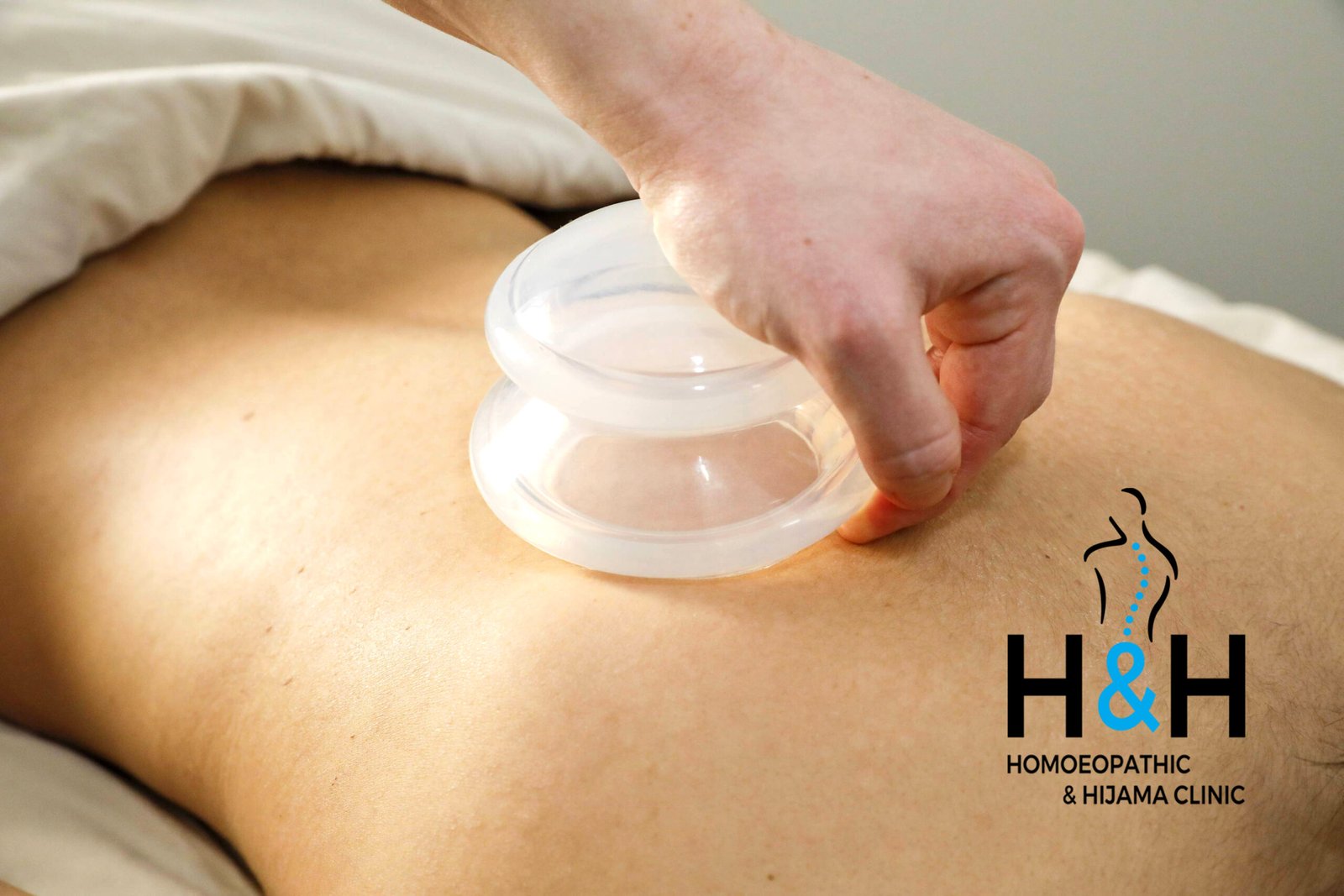 Massage Cupping copy scaled 1